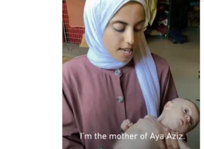 Mother holding malnourished baby
