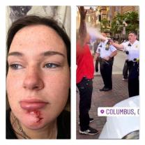 Person bleeding on the chin and cops macing man
