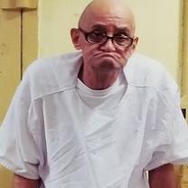 Bald old man with black-rimmed glasses and ears sticking out on each side of his had big a huge frown as if he has not teeth in a white hospital gown looking very sad